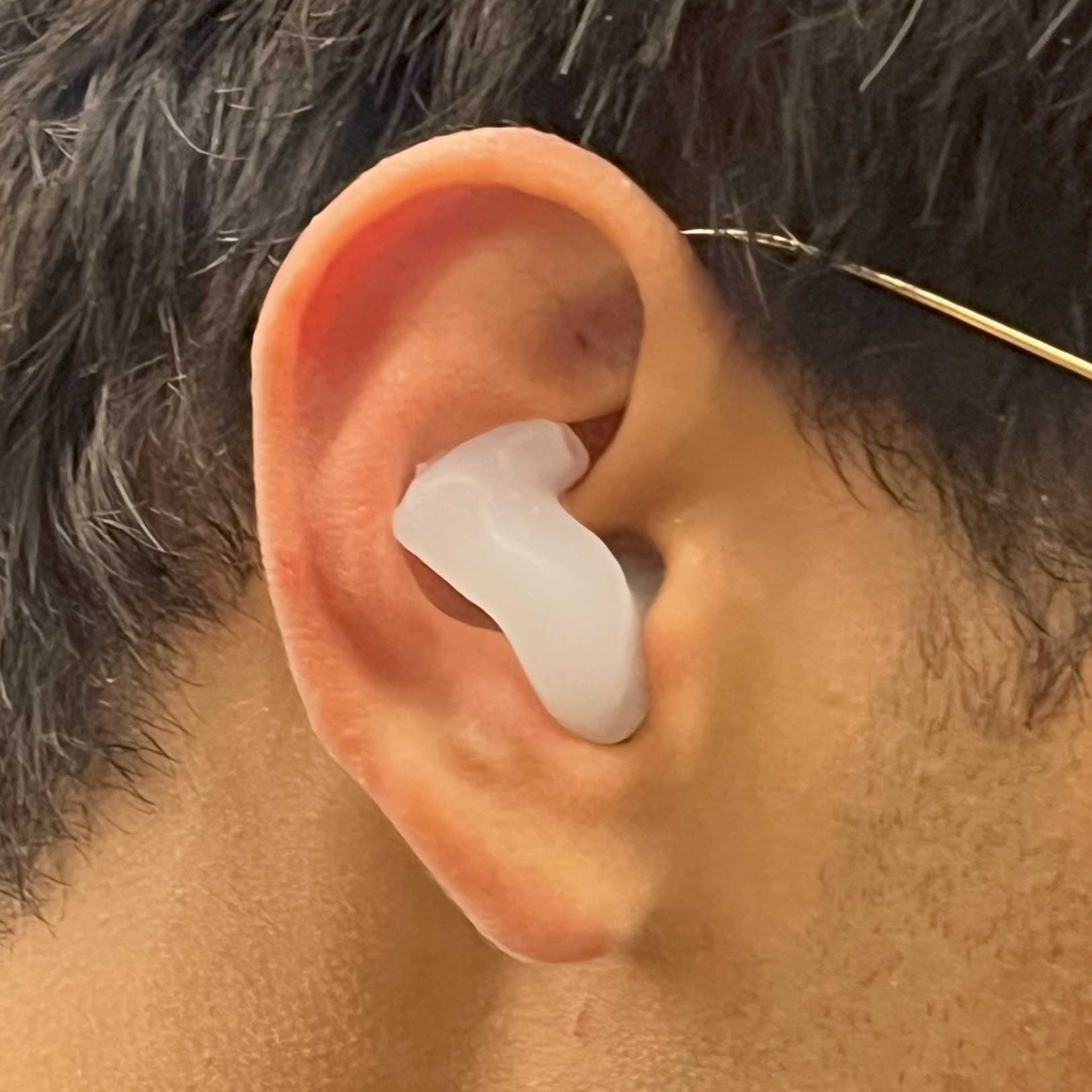 Earmold in Ear