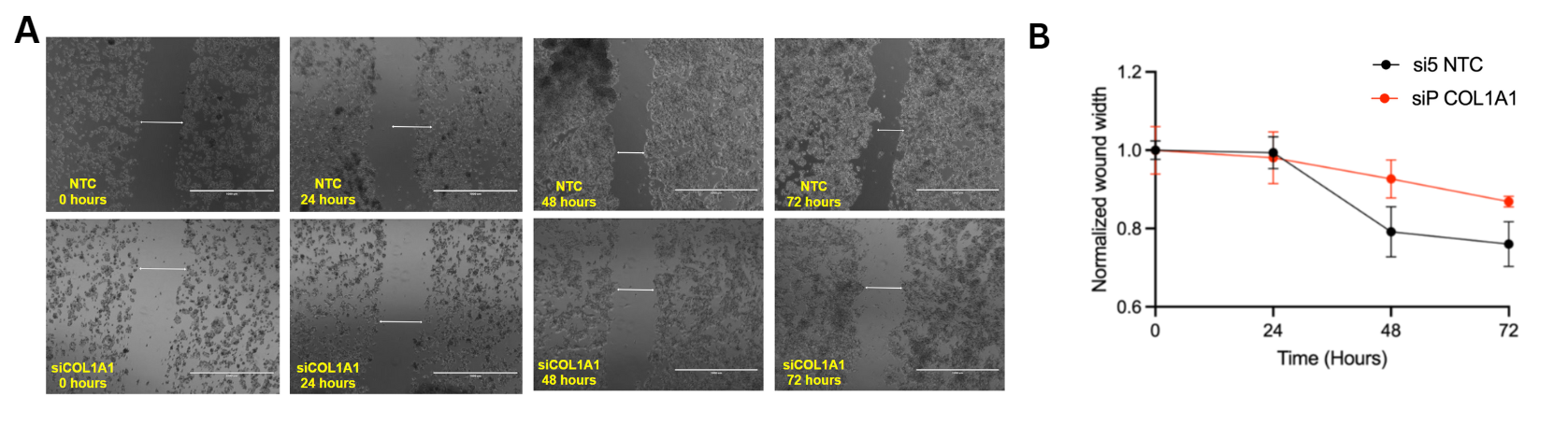 Wound Healing Assay