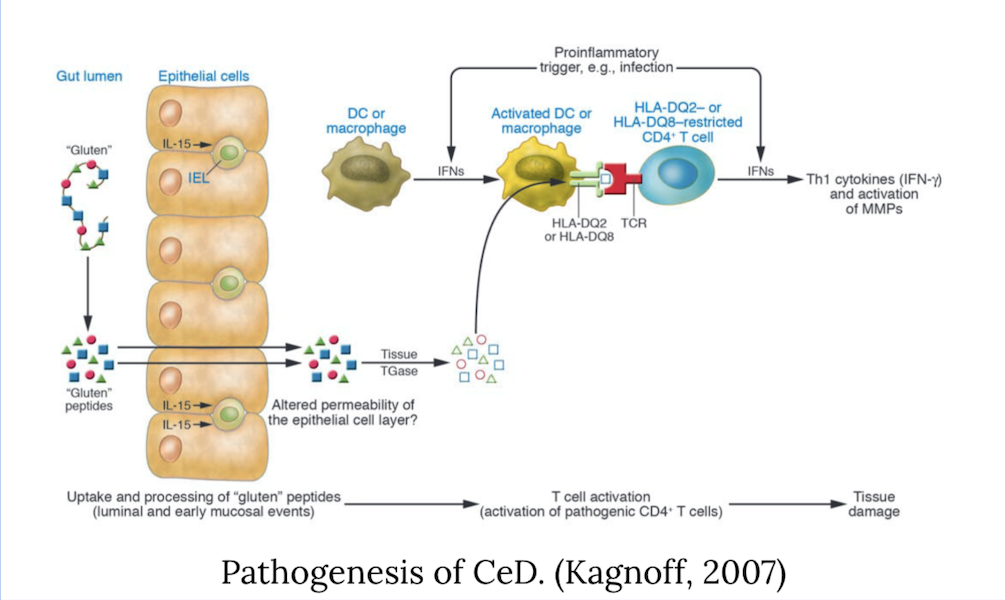 Pathogenesis of CeD