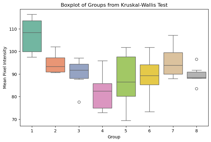 Boxplot