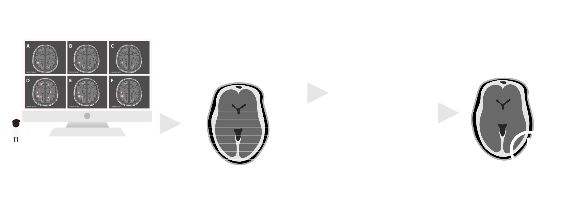 a graphical abstract