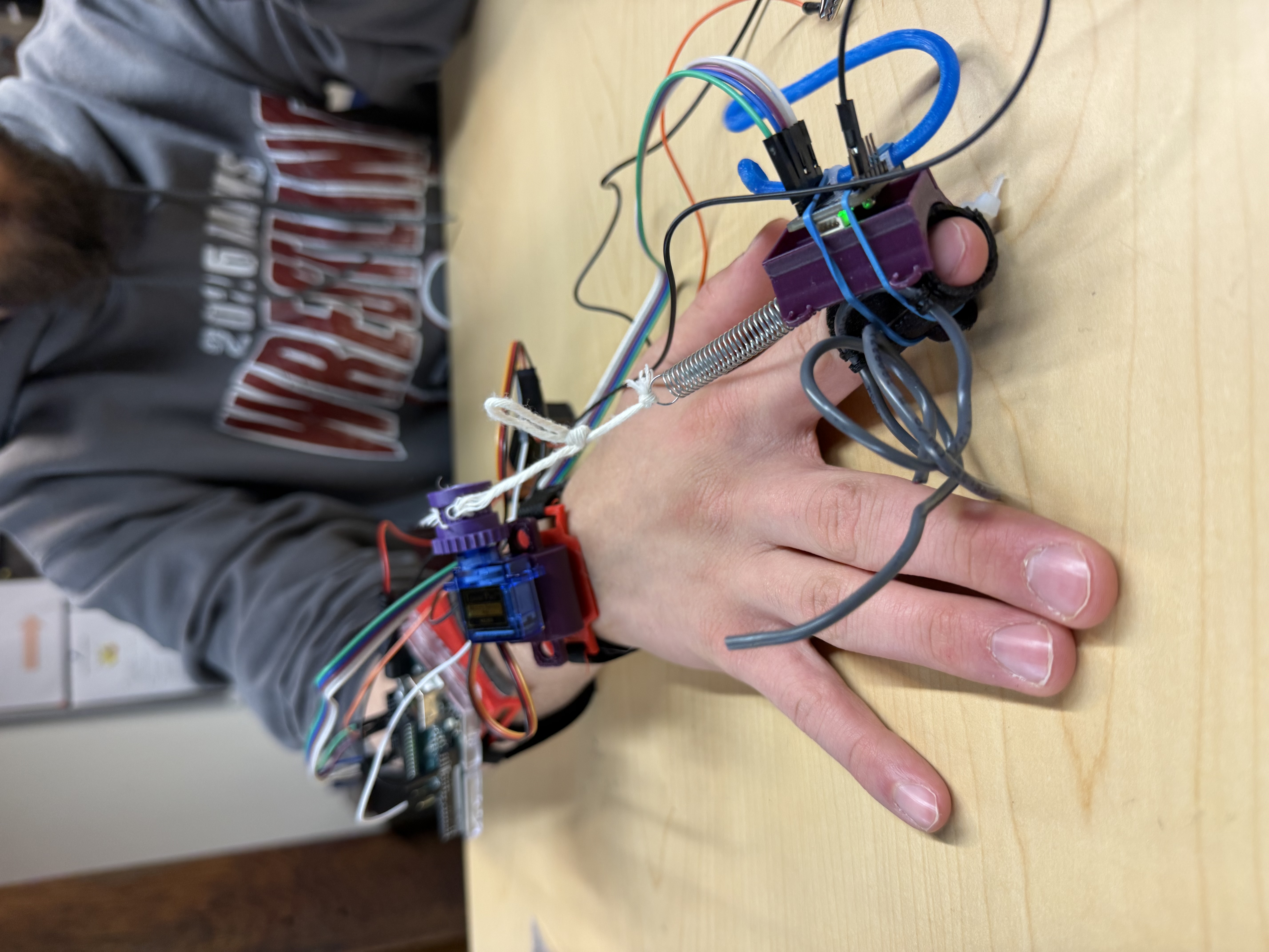DigiGuard prototype worn on the hand, showing the spring mechanism and wrist cuff